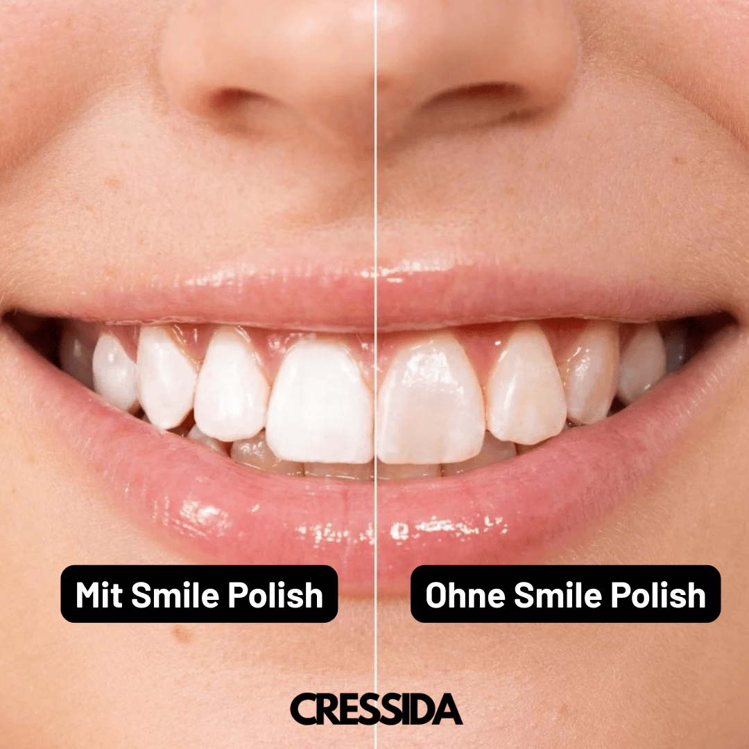Smile Polish