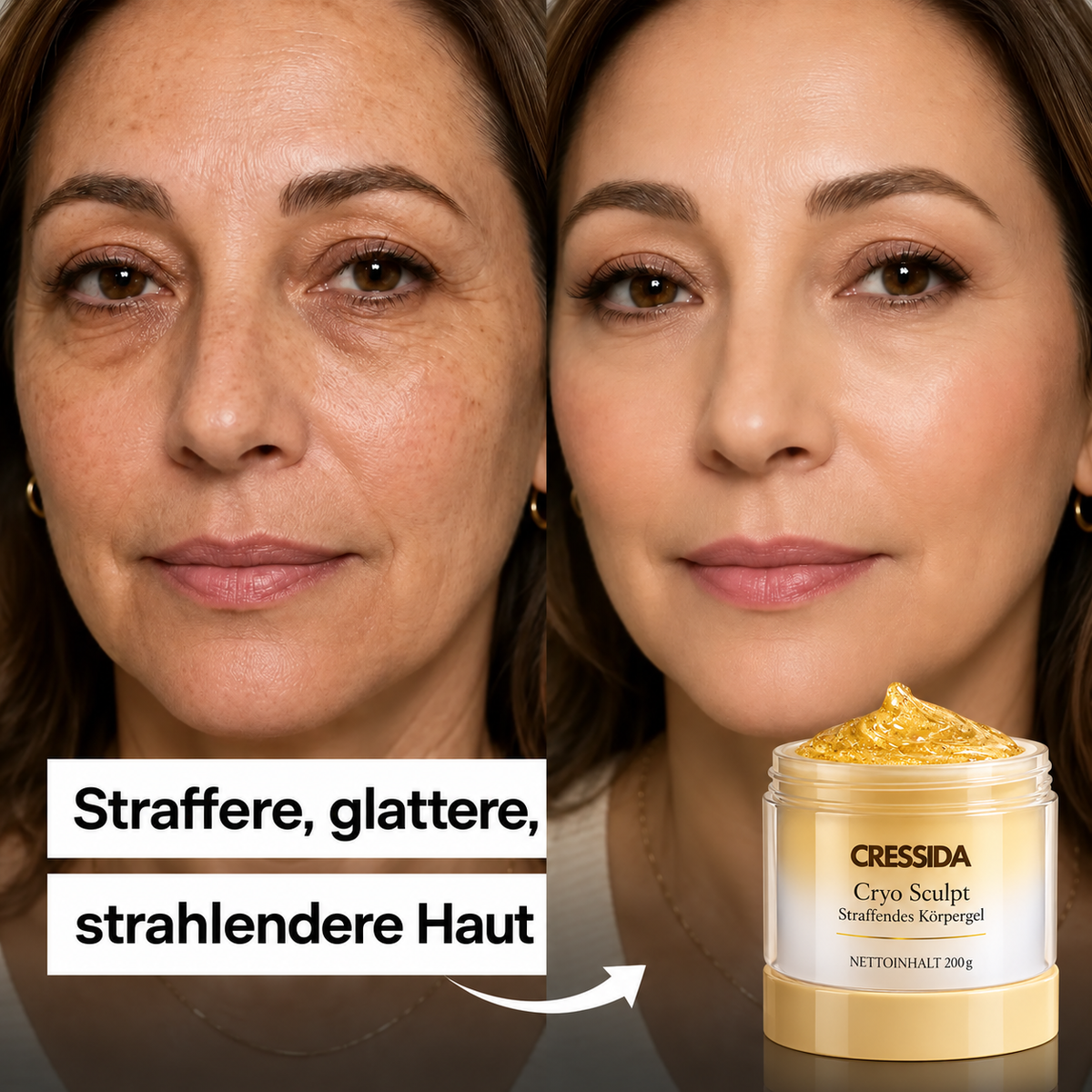 CryoSculpt – Straffendes Körpergel