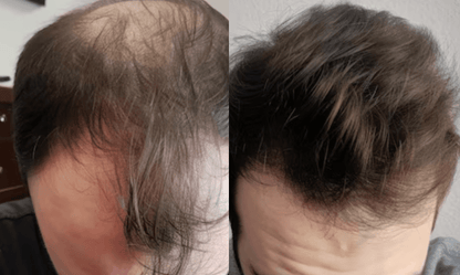 Haaröl für schnelles Wachstum