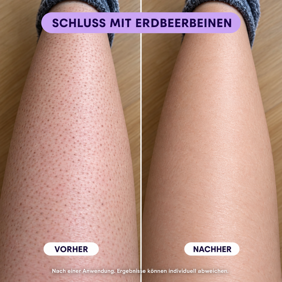Butterglatt | Haarentfernungsmousse