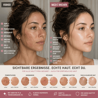 Glowy-Arbutin Creme