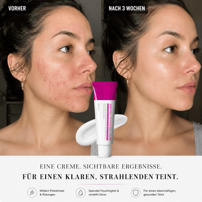 Glowy-Arbutin Creme