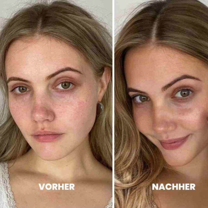Under Eye Glow