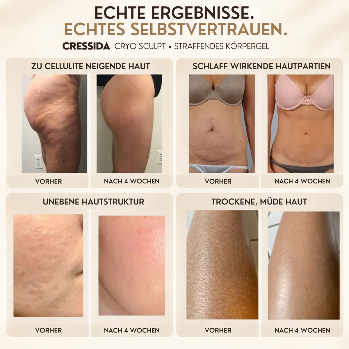 CryoSculpt – Straffendes Körpergel