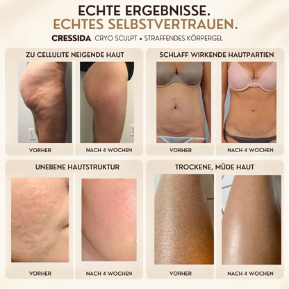 CryoSculpt – Straffendes Körpergel