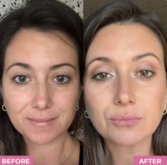 Lippen Booster Set